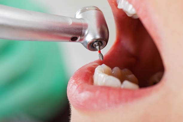 Best Emergency Treatment for Oral Infections in Pittsburg, CA